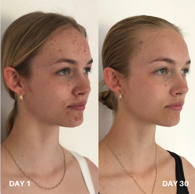 Oчищувач для шкіри Clinisoothe+ Skin Purifier