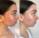 Oчищувач для шкіри Clinisoothe+ Skin Purifier
