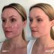 Oчищувач для шкіри Clinisoothe+ Skin Purifier