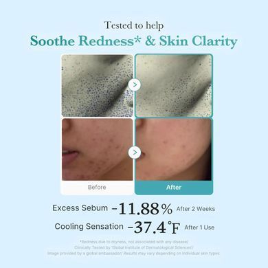 Тонер з азелаїновою кислотою та ніацинамідом Medicube Azelaic Acid Niacinamide Clear Toner