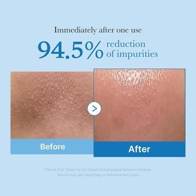 Сироватка з кислотами для звуження пор Medicube Zero Pore One Day Serum