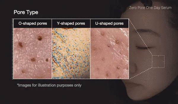 Сироватка з кислотами для звуження пор Medicube Zero Pore One Day Serum