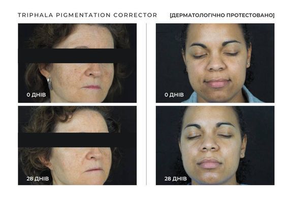 Сироватка для корекції пігментації SACHI Skin Triphala Pigmentation Corrector