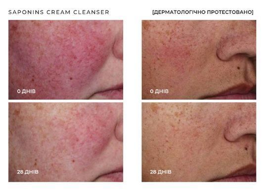 Кремовий засіб для очищення шкіри обличчя SACHI Skin Saponins Cream Cleanser
