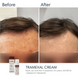 Крем проти пігментації Braderm Tramexal Cream