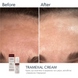 Крем проти пігментації Braderm Tramexal Cream