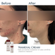 Крем проти пігментації Braderm Tramexal Cream