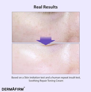 Тонізуючий крем з глутатіоном та бакучіолом DermAfirm Soothing Repair Toning Cream R4