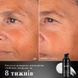 Інноваційна сироватка з мініпротеїнами Medik8 Liquid Peptides Advanced MP