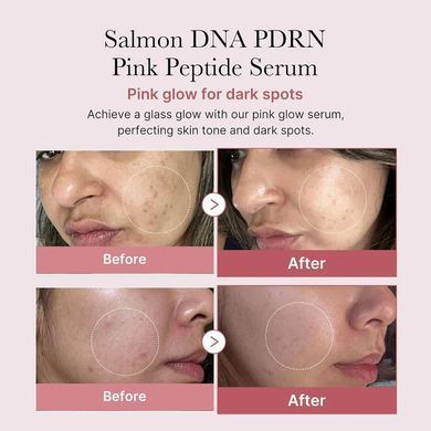 Відновлювальна сироватка з полінуклеотидами та пептидами Medicube PDRN Pink Peptide Serum